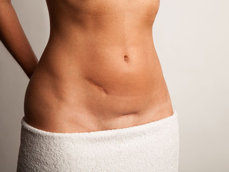 Paramedical Cosmetic Correction