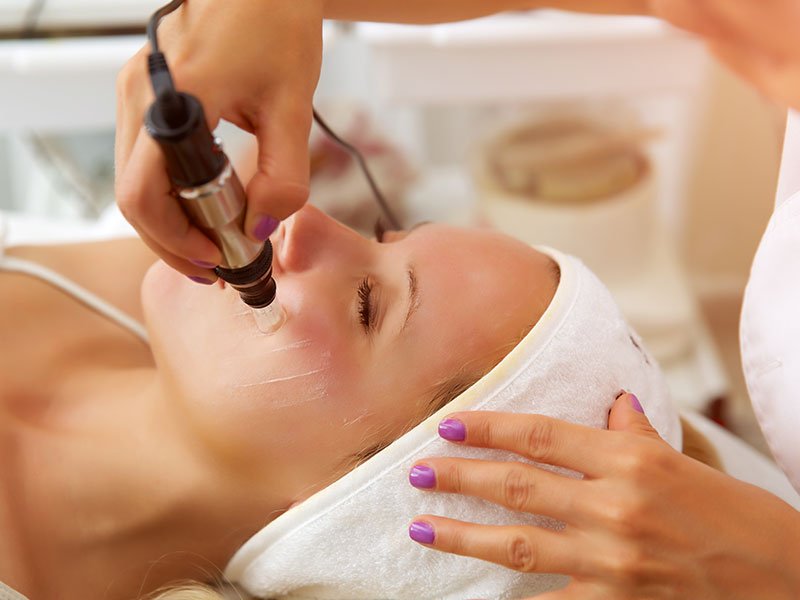 prp microneedling gallery 03